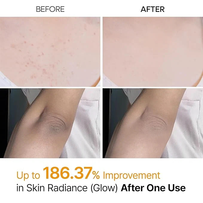 Dr.Melaxin - Peel Shot Kojic Acid Spray
