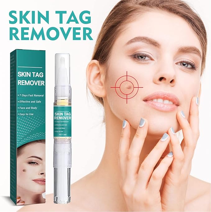 West & Month - Skin Tag Remover